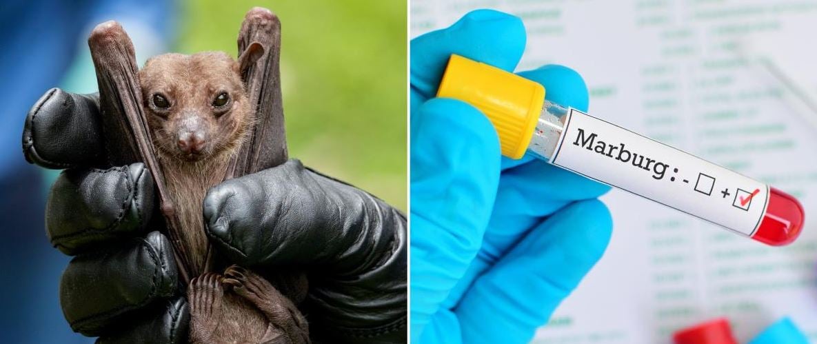 الصحة العالمية تحذر من تفشى فيروس قاتل في إثيوبيا لا يوجد له علاج أو لقاح فعال